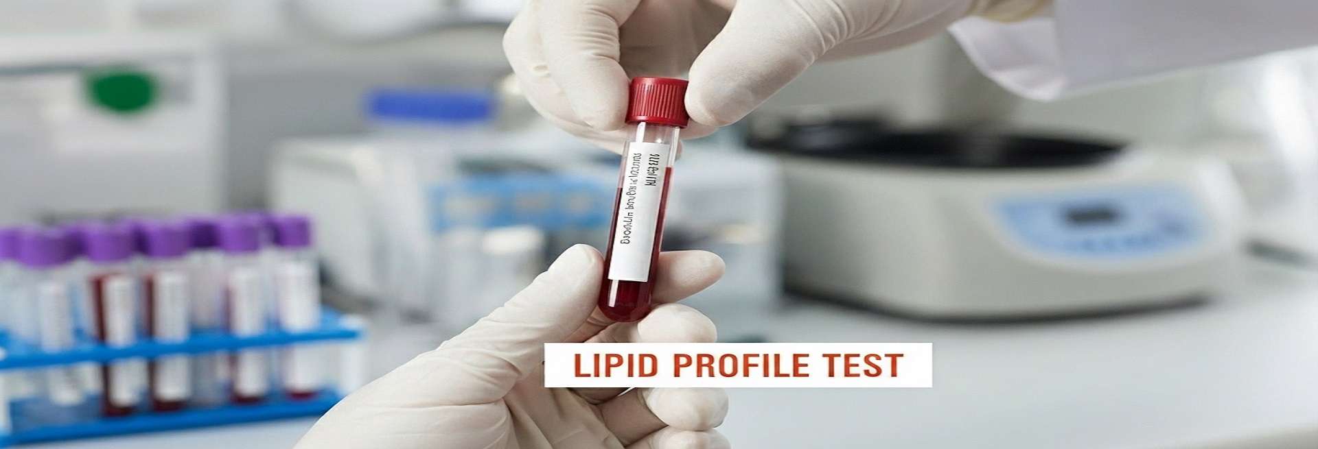 lipid-profile-test-in-kolkata